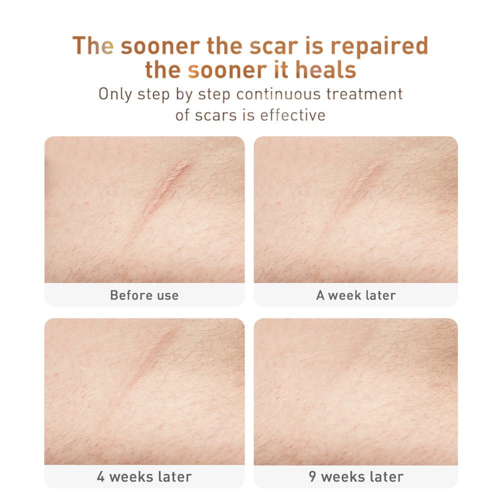 Scar Removal Cream Care Cream Face Care Products