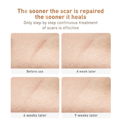 Scar Removal Cream Care Cream Face Care Products